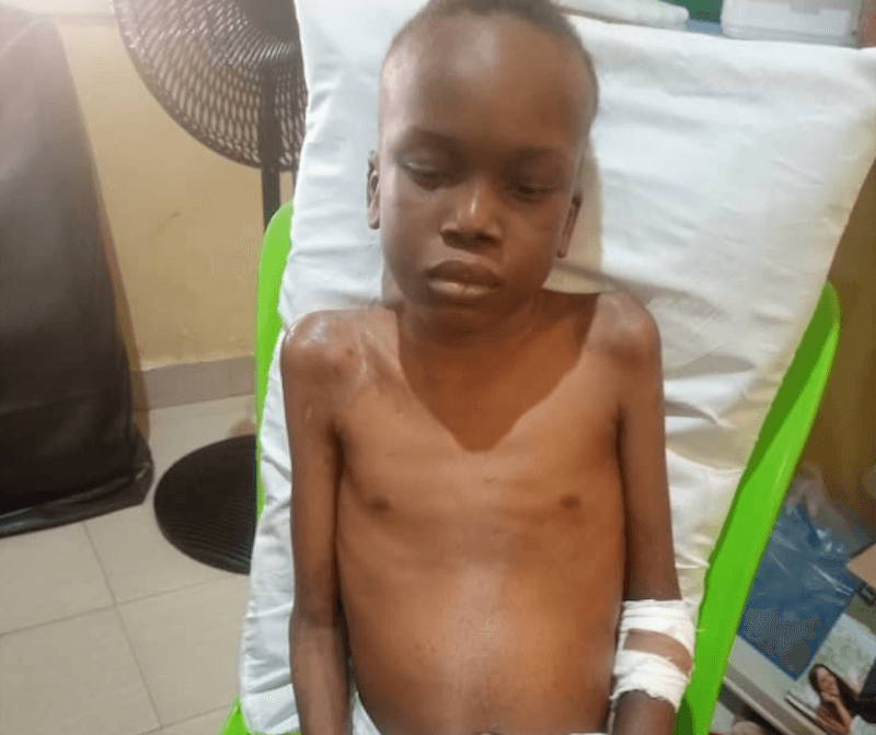 10-year-old Stroke Patient Desperately Needs N7m for Multiple Surgeries